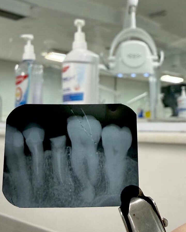 Radiografia odontológica